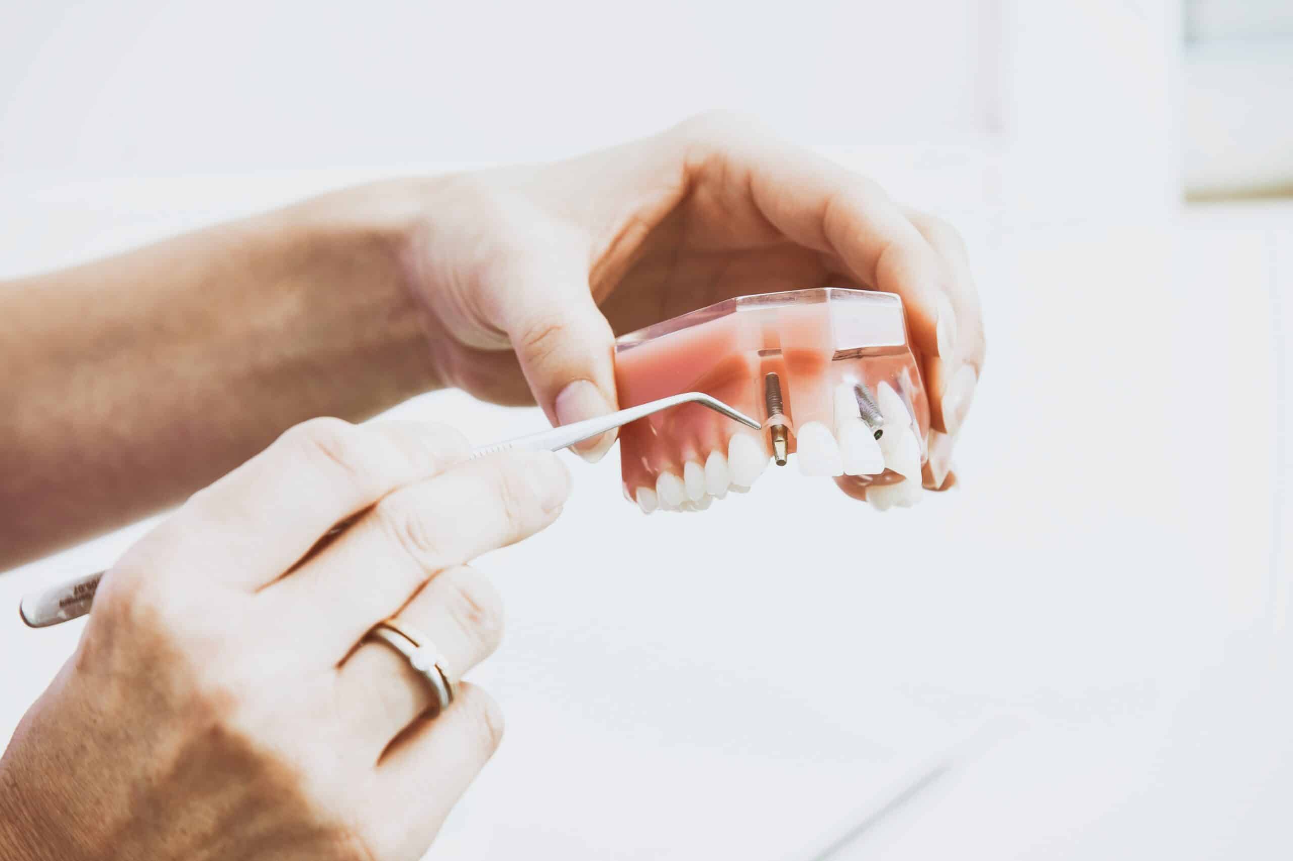 Dentist pointing to a dental implant model - Periodontist Southern Pines & Sanford NC | Van Scoyoc Periodontics & Implants Dentist pointing to a dental implant model