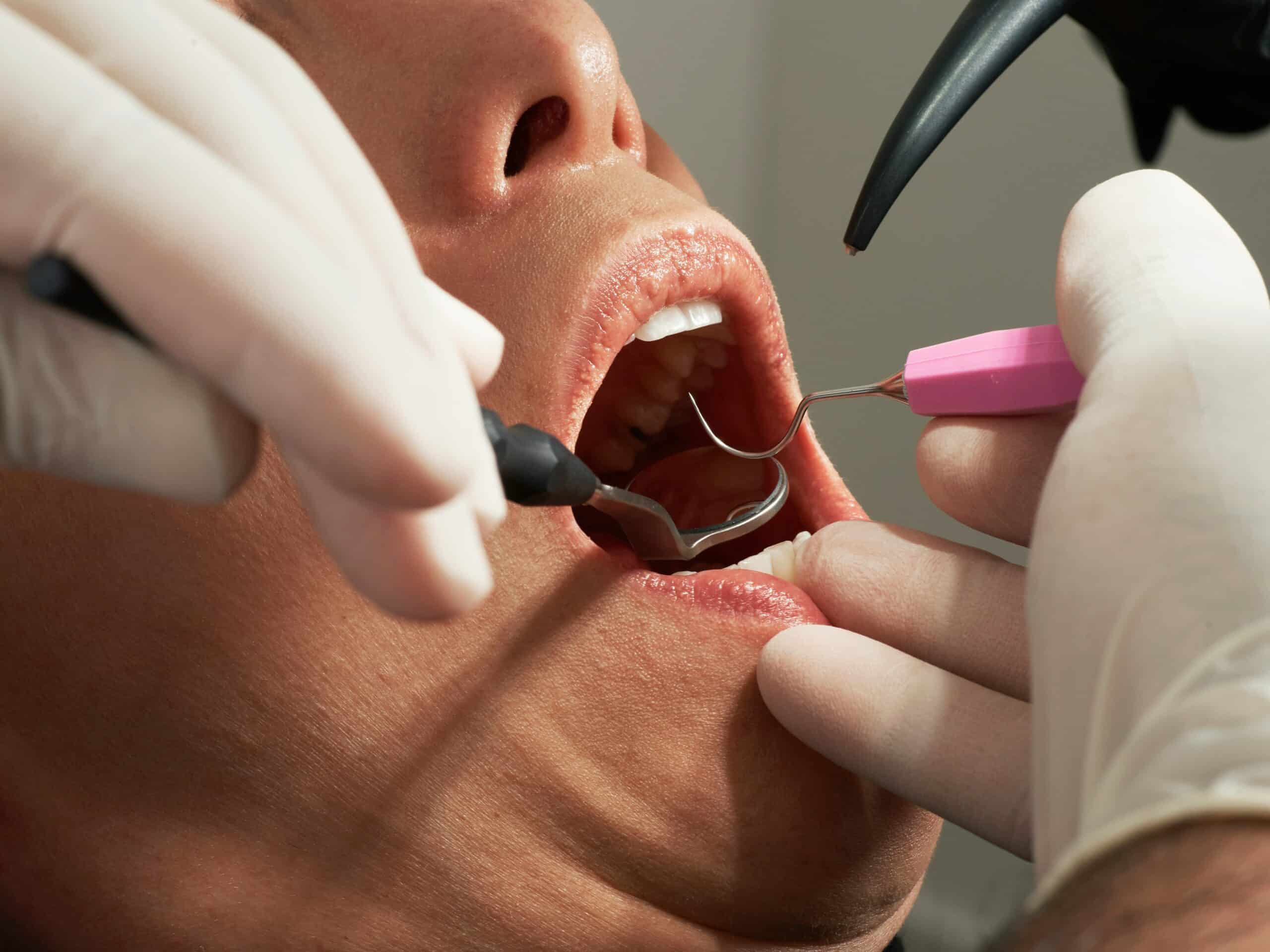 Dentist examining a patient's teeth with a mirror and probe