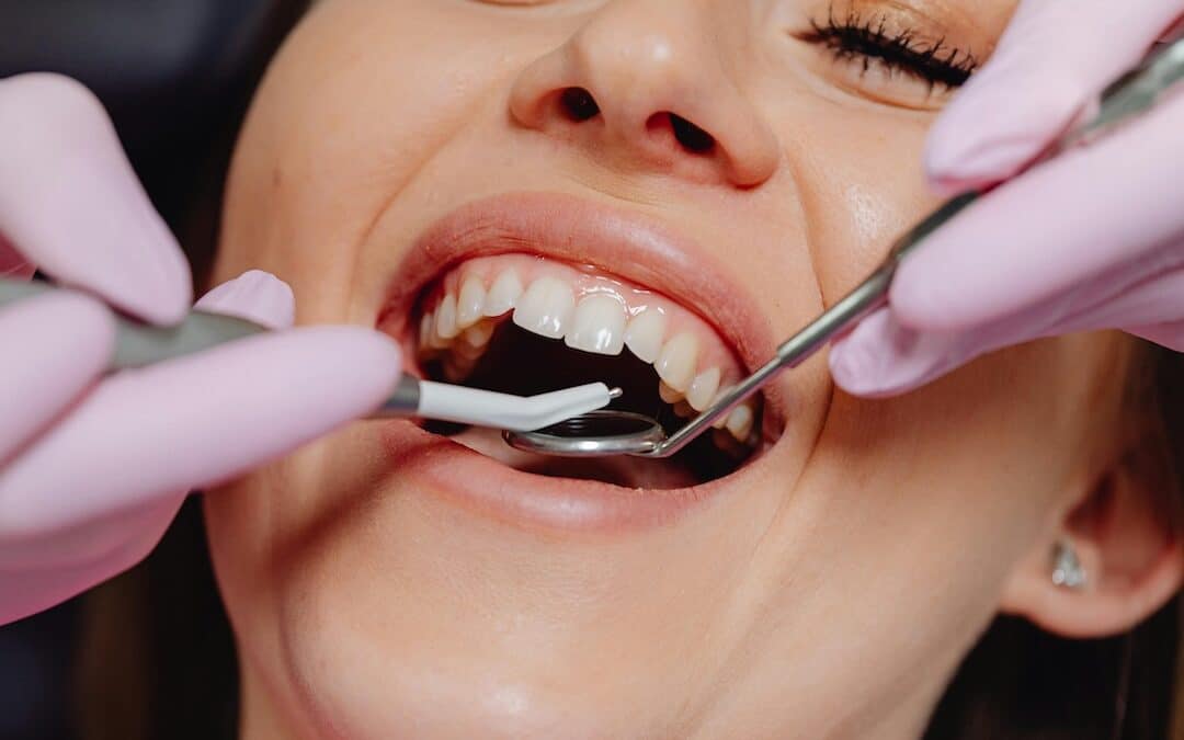 Perioscopy is a new surgery-free dental procedure to address gum disease